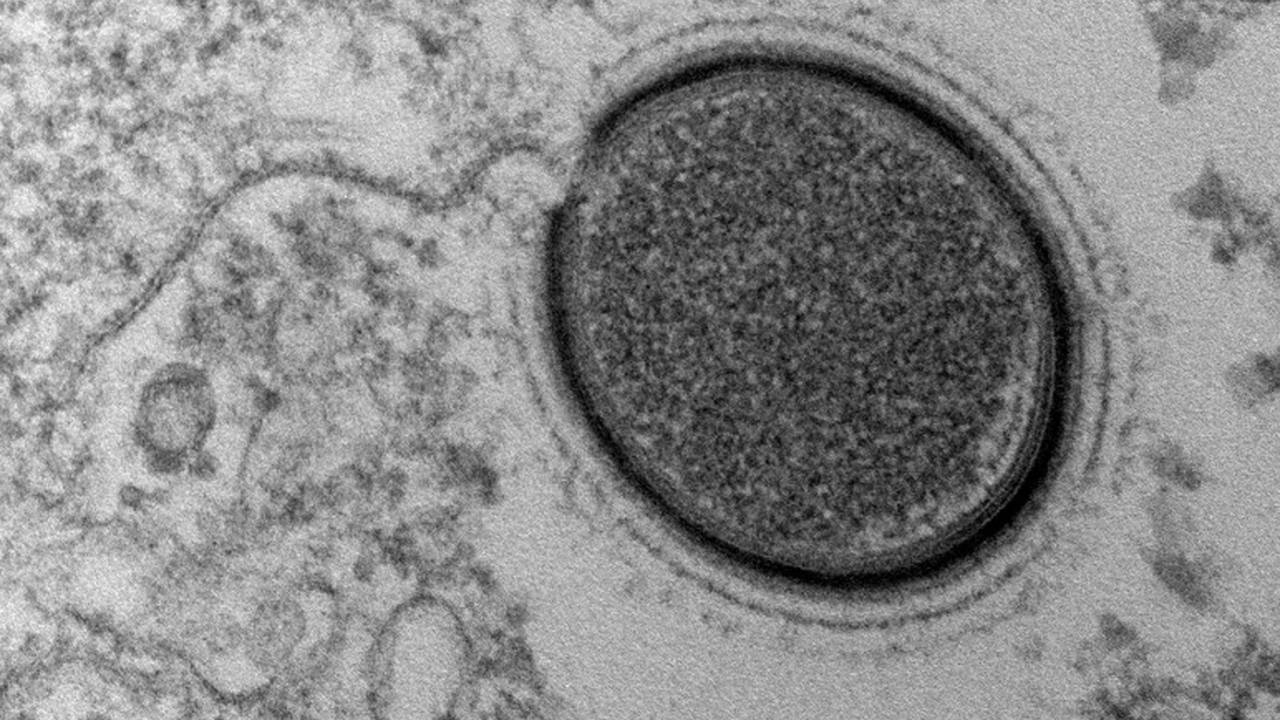 O 'Mollivirus sibericum' tem 0,6 micrômetro de comprimento (1 micrômetro equivale à milésima parte do milímetro) e 650 000 genes