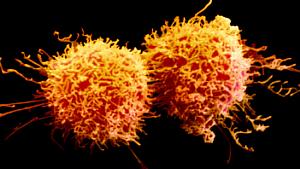 Células cancerosas