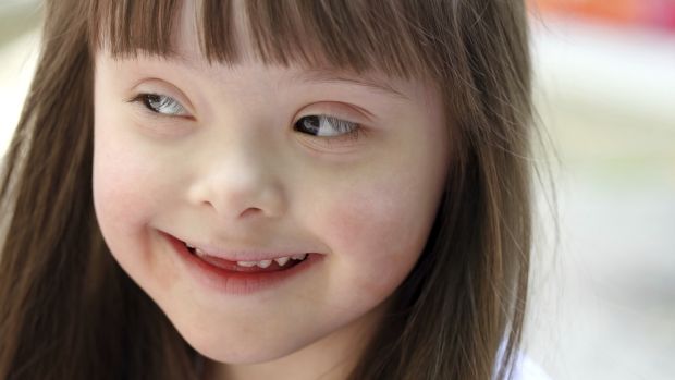 Mapeamento cerebral investiga maior risco de demência na síndrome de Down