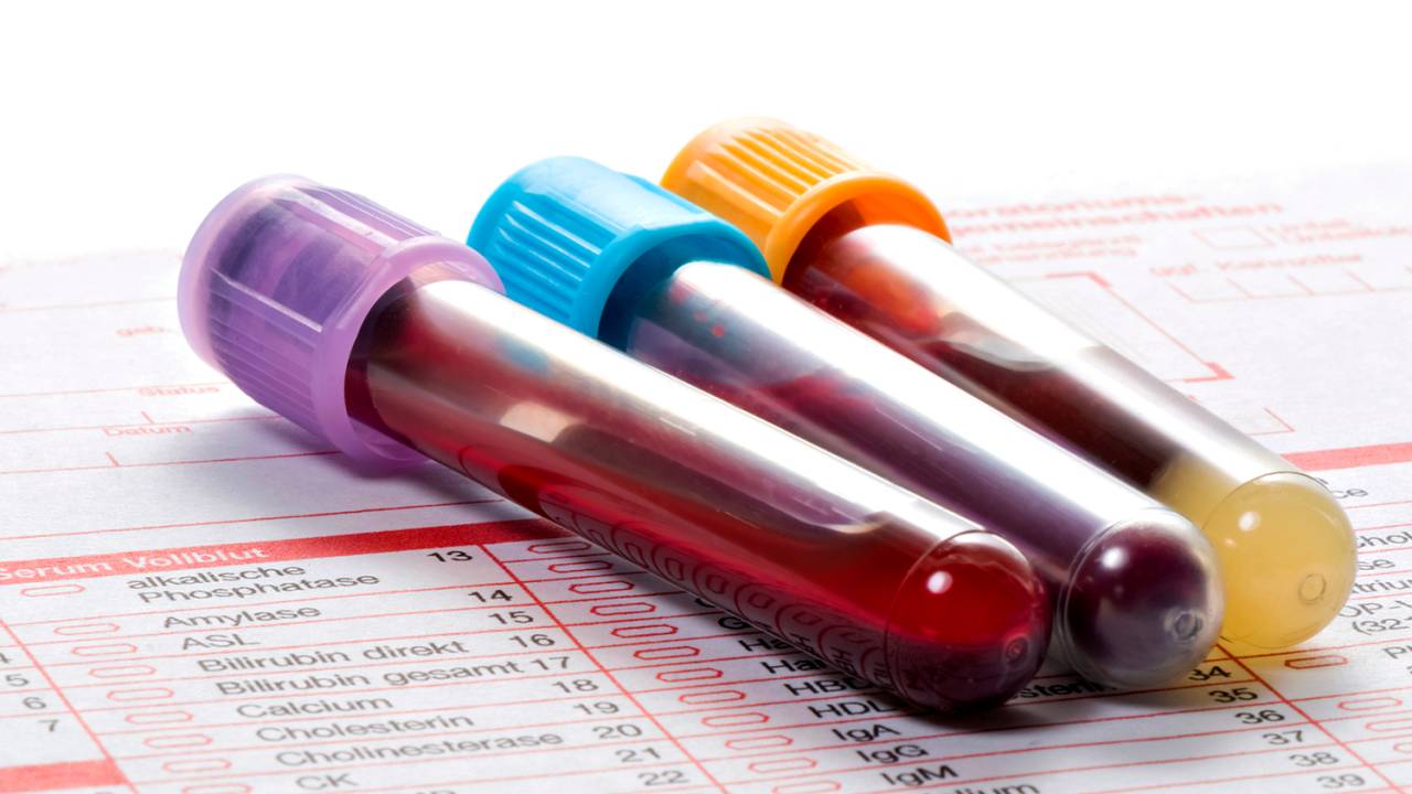 Exame de sangue - Amostras