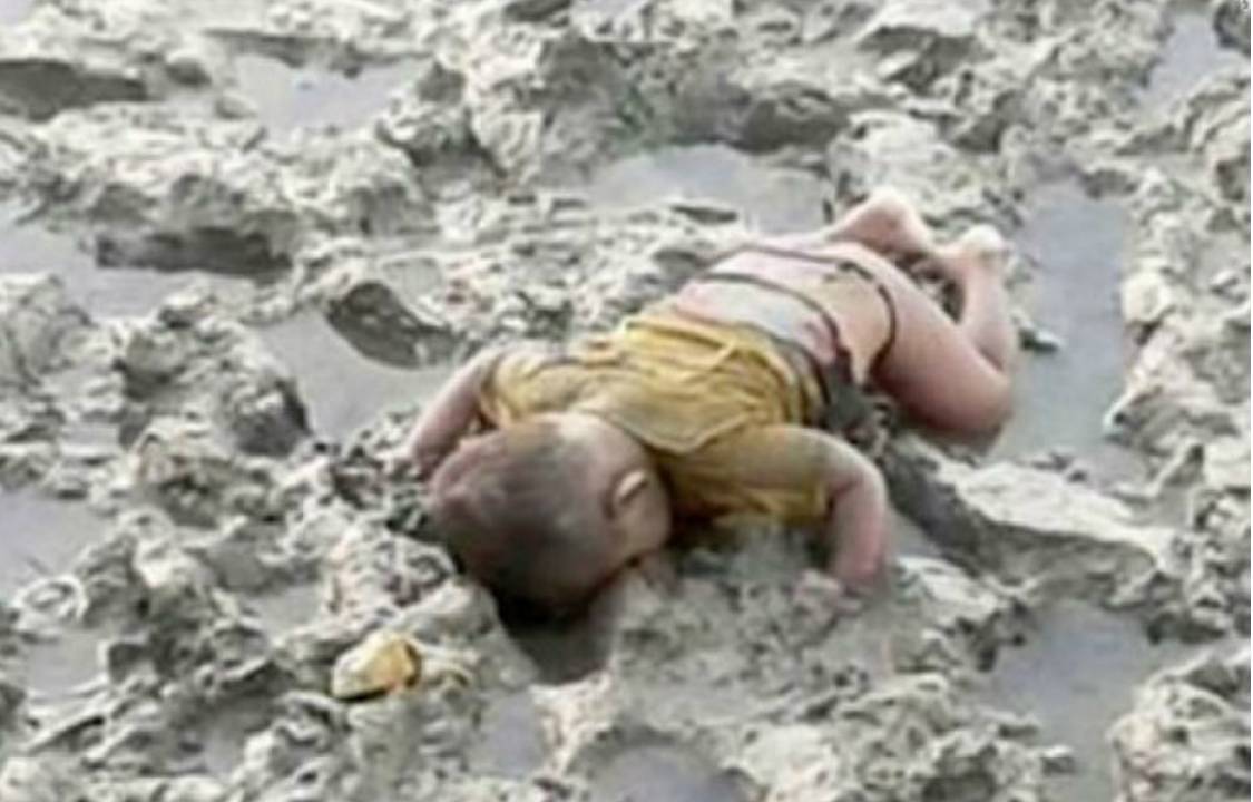 O bebê Mohammed Shohayet, de 16 meses