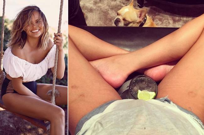 Modelo Chrissy Teigen publica foto de suas estrias no Instagram