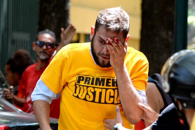 O deputado Juan Requesens, atingido por um cassetete, durante o protesto desta segunda (3) contra o governo de Nicolás Maduro em Caracas, Venezuela - 03/04/2017 O deputado Juan Requesens, atingido por um cassetete, durante o protesto desta segunda (3) contra o governo de Nicolás Maduro em Caracas, Venezuela - 03/04/2017