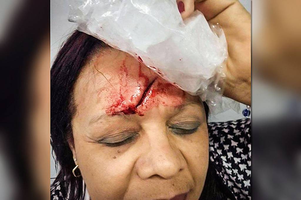 Shirlei Maia – Diretora de é escola é agredida