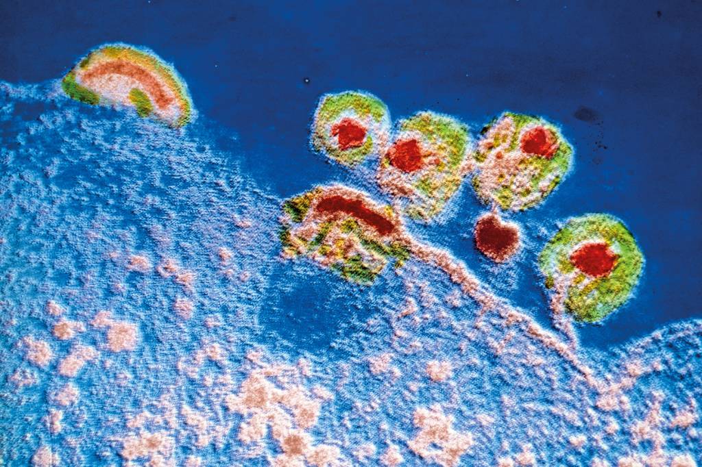 O plano B contra a aids