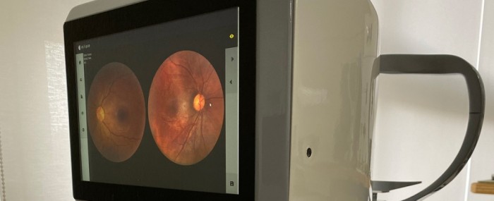 Retinógrafo brasileiro pode custar cinco vezes menos que convencionais