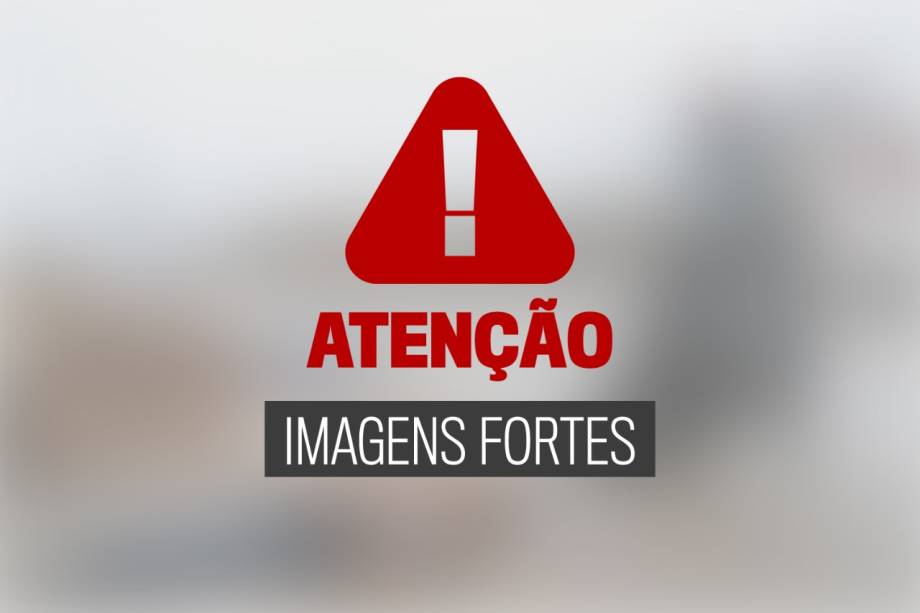 ATENÇÃO - A galeria a seguir contêm imagens fortes - ATENÇÃO - A galeria a seguir contêm imagens fortes -