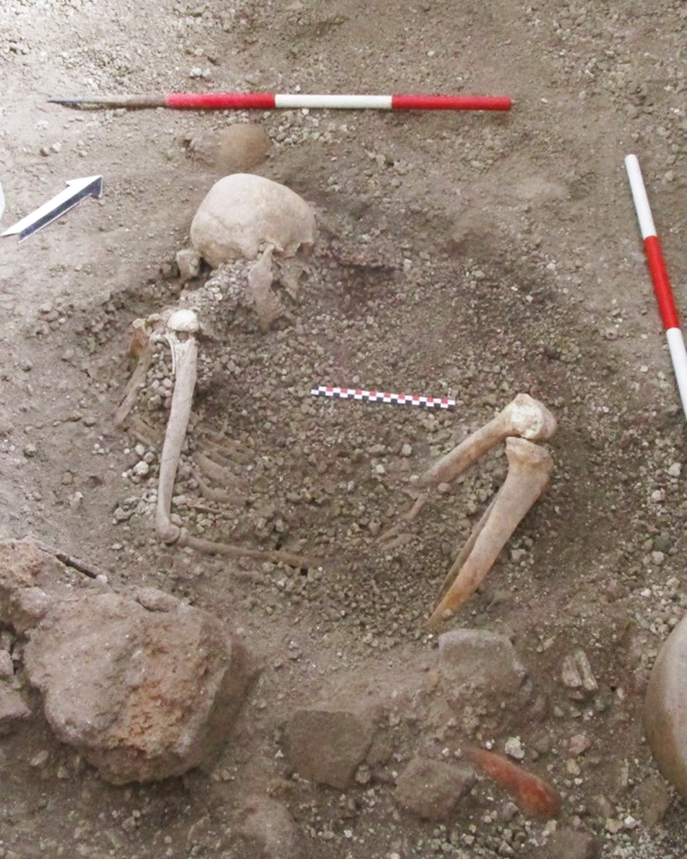 pompeia_2.jpg VÍTIMA - Esqueleto que foi alvo da pesquisa: após a erupção, ele tentou se proteger, mas foi esmagado