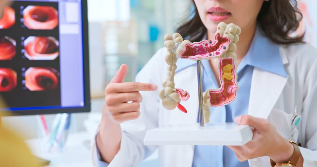 Casos de câncer de intestino no país devem saltar 21% nos próximos 15 anos