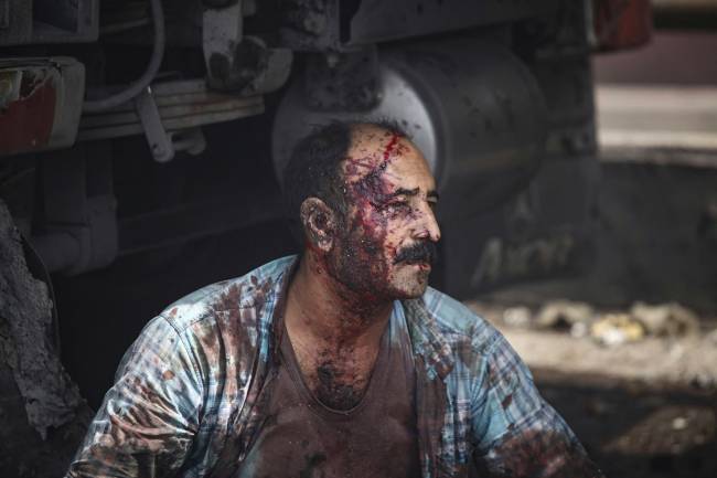 EDITORS NOTE: Graphic content / An injured man sits on the ground along a highway near the source of an explosion at the Shahid Rajaee port dock southwest of Bandar Abbas in the Iranian province of Hormozgan on April 26, 2025. Several containers exploded on April 26 at Iran's largest commercial port, authorities said, causing a major blast and fire, and leaving hundreds injured. Shahid Rajaee, more than 1,000 kilometres (620 miles) south of the capital, is the most advanced container port in Iran, according to the official IRNA news agency. (Photo by MOHAMMAD RASOLE MORADI / IRNA / AFP)