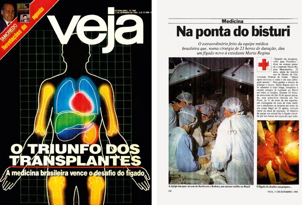 2a—Veja-n-888-(1)-1 PRIMÓRDIOS - A histórica notícia: o primeiro transplante de fígado em VEJA