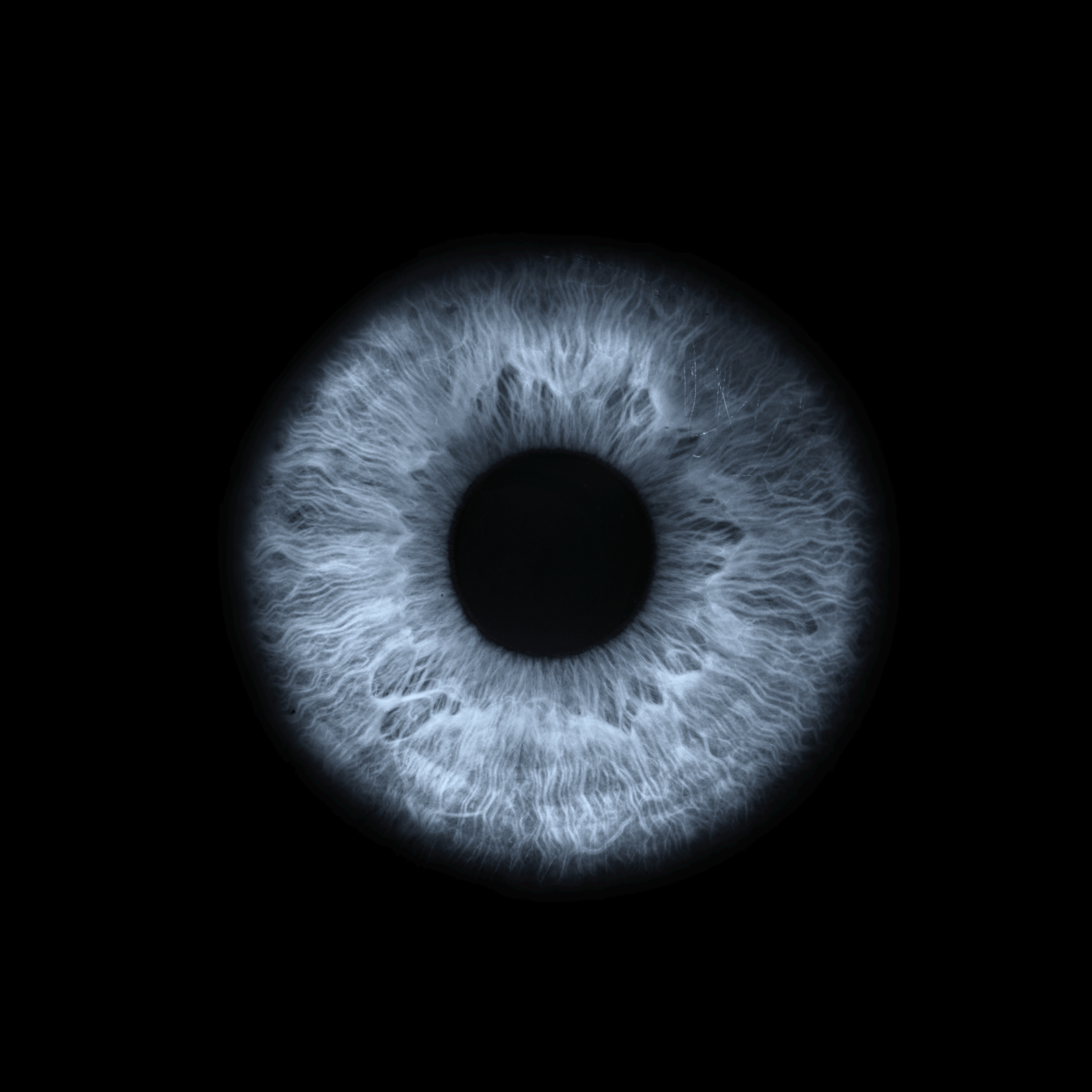 Entidades lançam manifesto por rigor na venda de colírios por risco de glaucoma