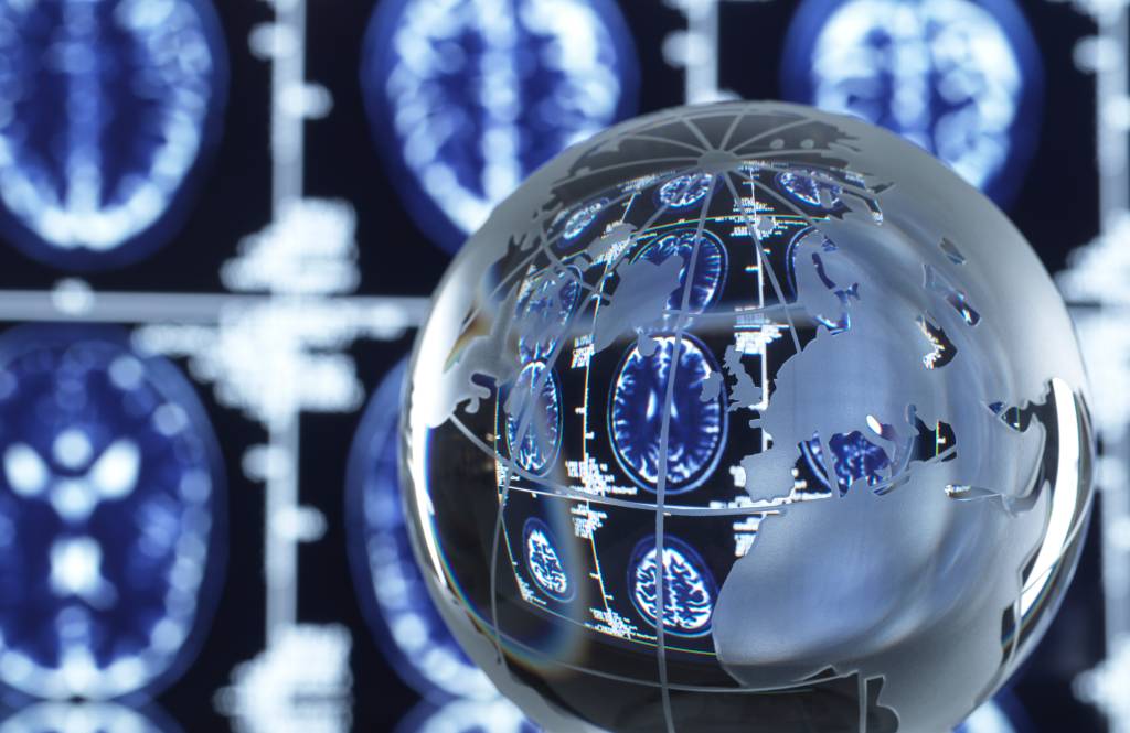 Descoberta científica pode ajudar a tratar doença de Huntington; entenda