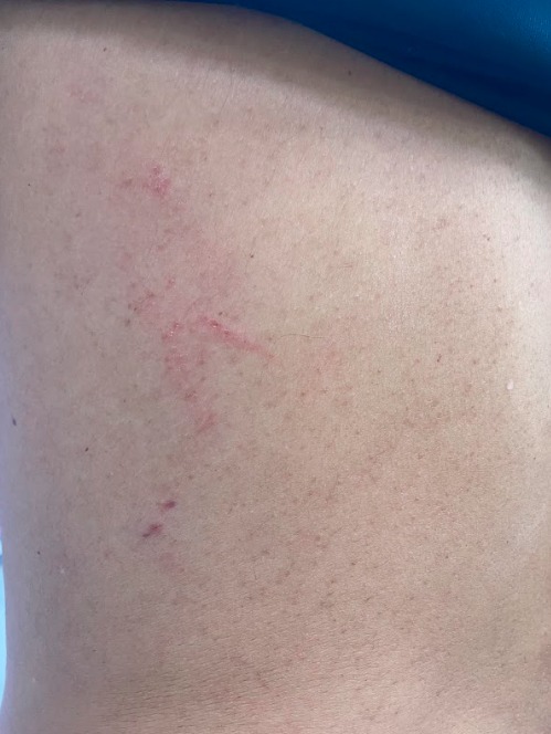 Foto mostra como ficou policial ferido em ação contra Oruam; cantor teve mandado de prisão expedido