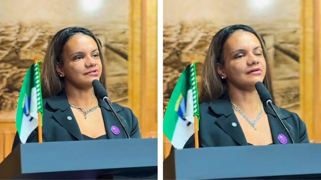 Vídeo: Após 1 mês, mulher que levou 61 socos recebe medalha e mostra rosto