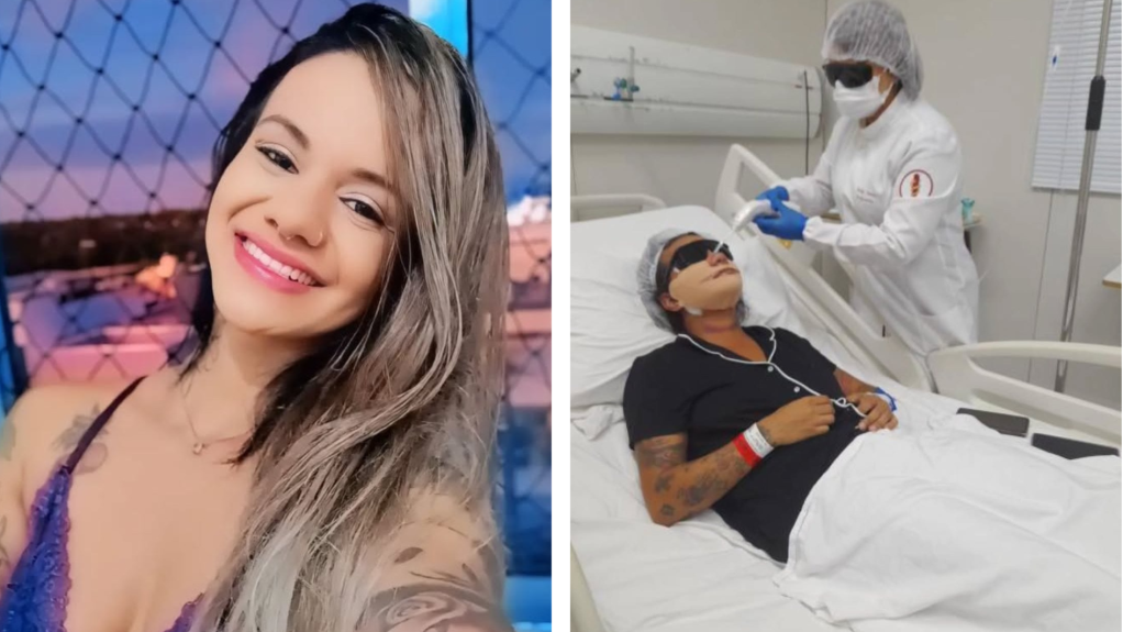 Mulher que levou 61 socos do namorado mostra rosto após cirurgia