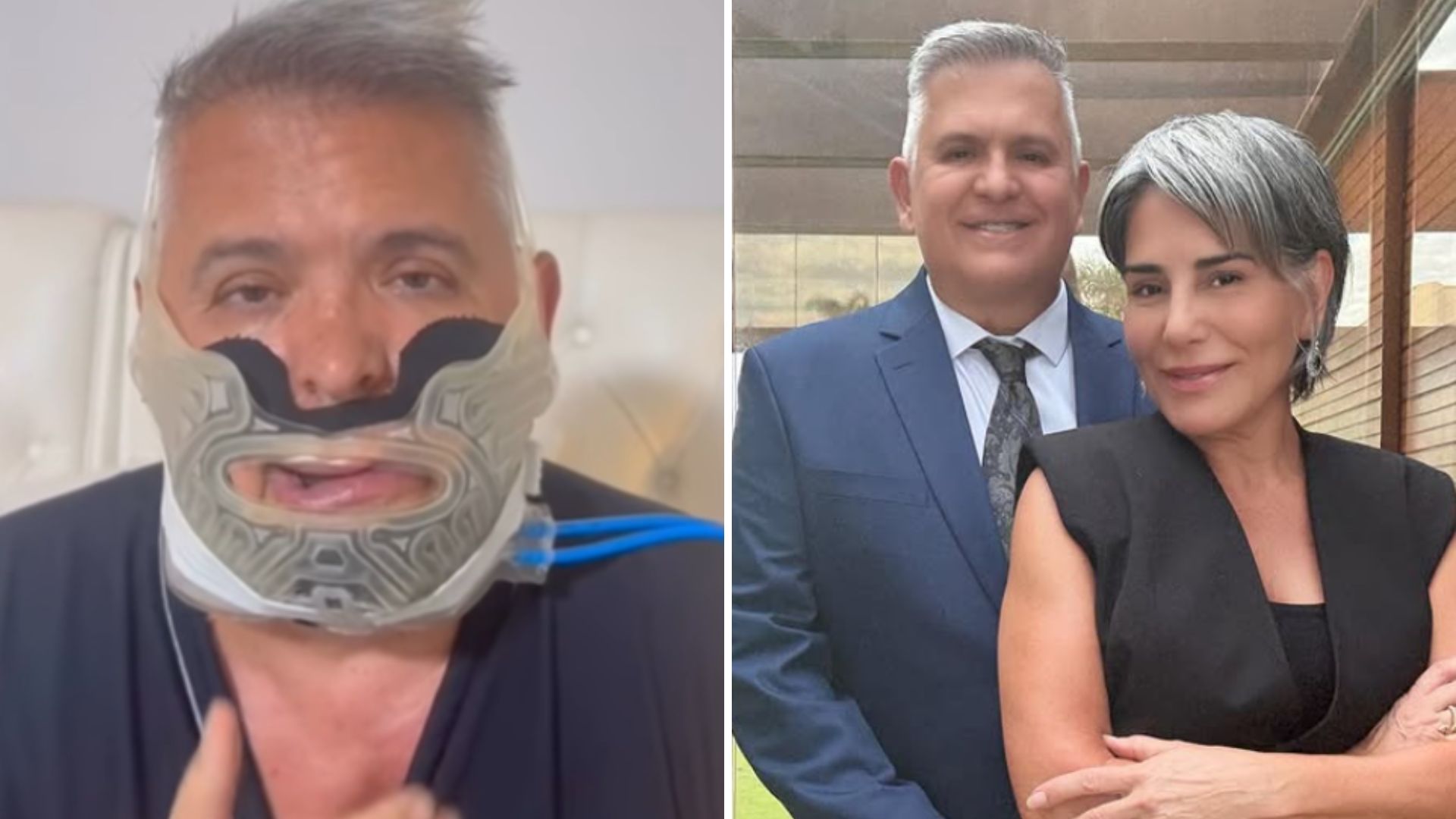 O motivo da cirurgia no rosto de Orlando Morais, marido de Glória Pires