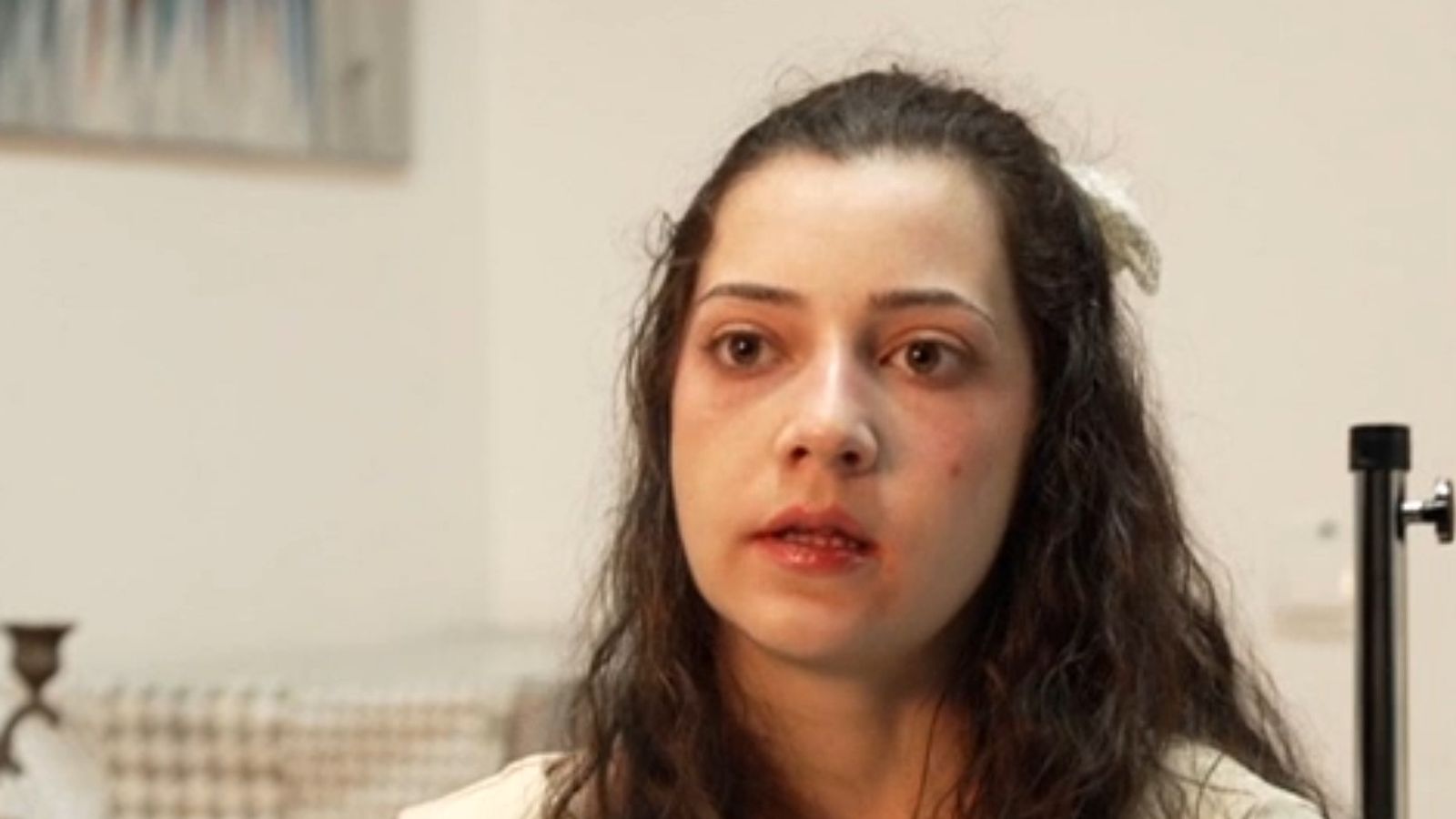 mulher espanhola vítima de violência eutanásia