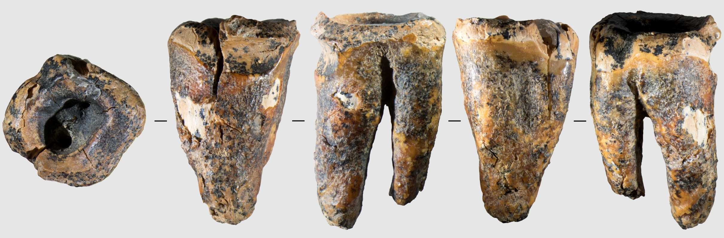 Há 59 mil anos, neandertais já faziam ‘tratamentos dentários’