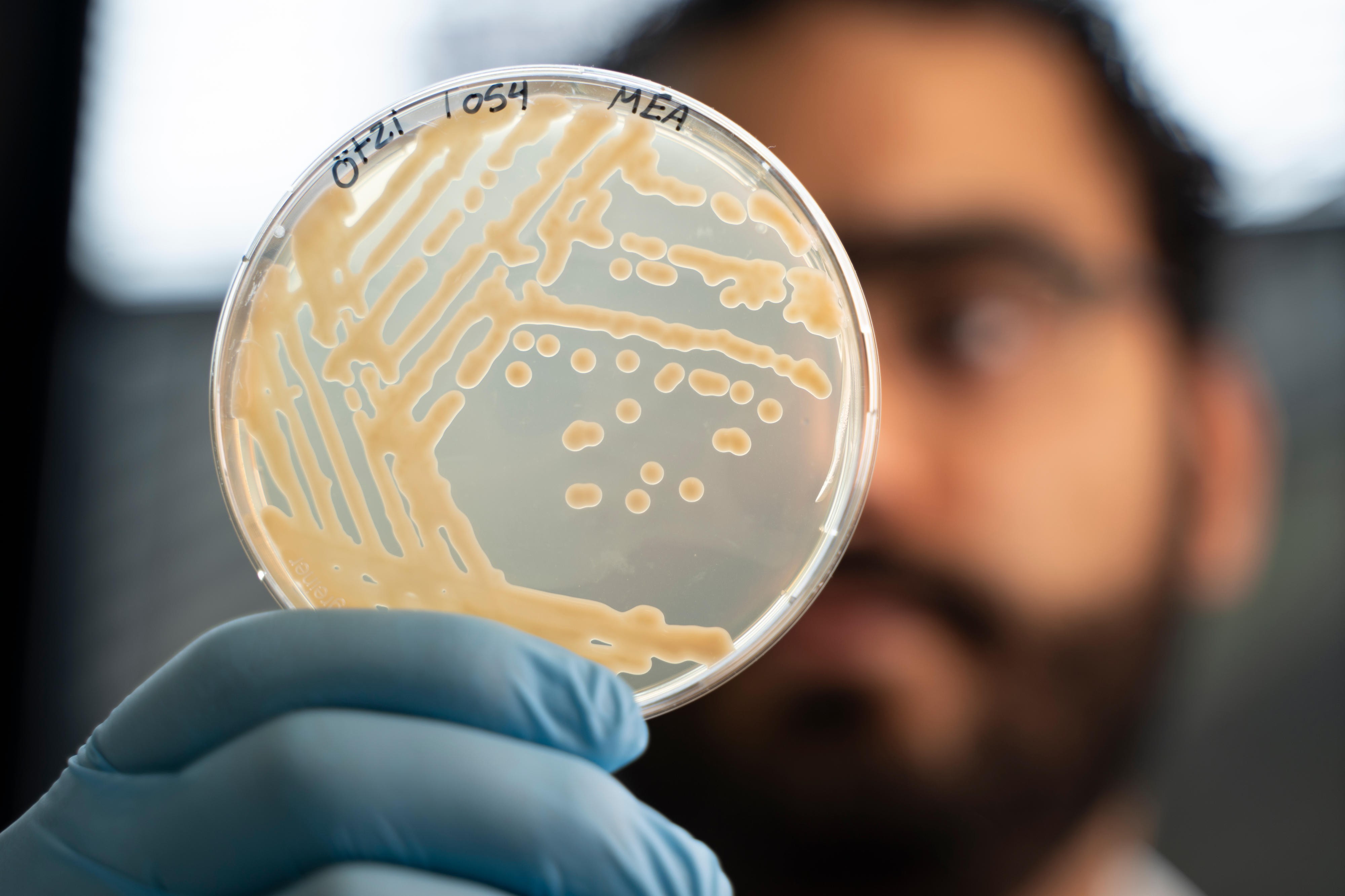Microbioma de ‘homem do gelo’ ainda está em atividade, segundo pesquisa