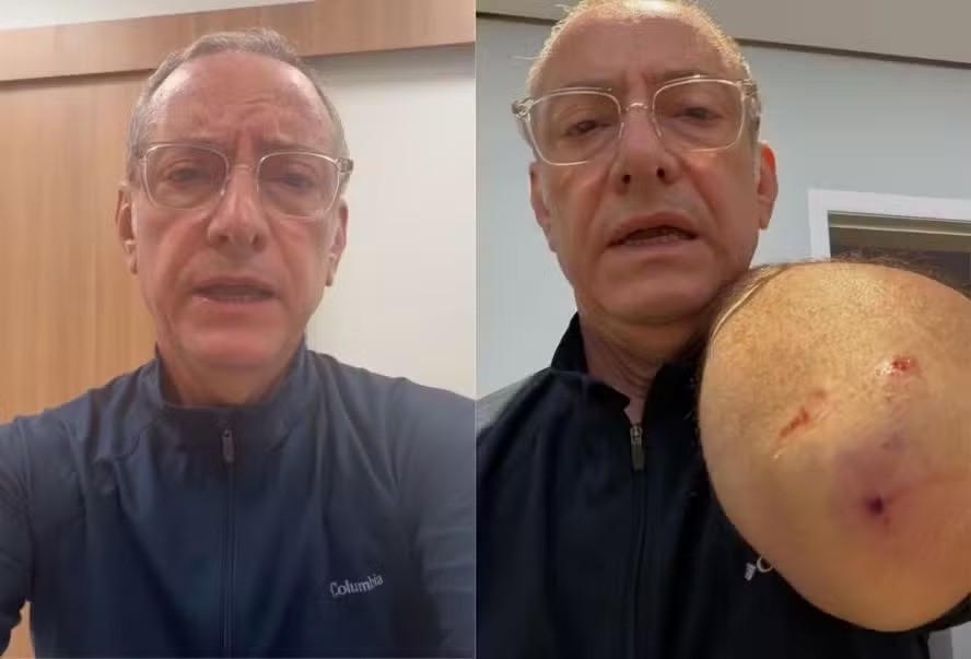 O estado de saúde de José Roberto Burnier, do ‘SP2’, atacado por pitbull
